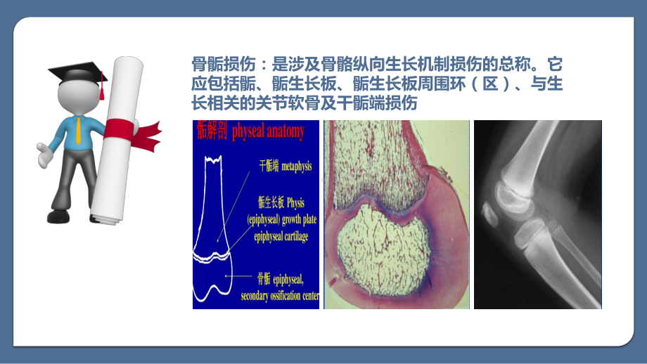 骨骺损伤的影像学表现课件.pptx_第2页