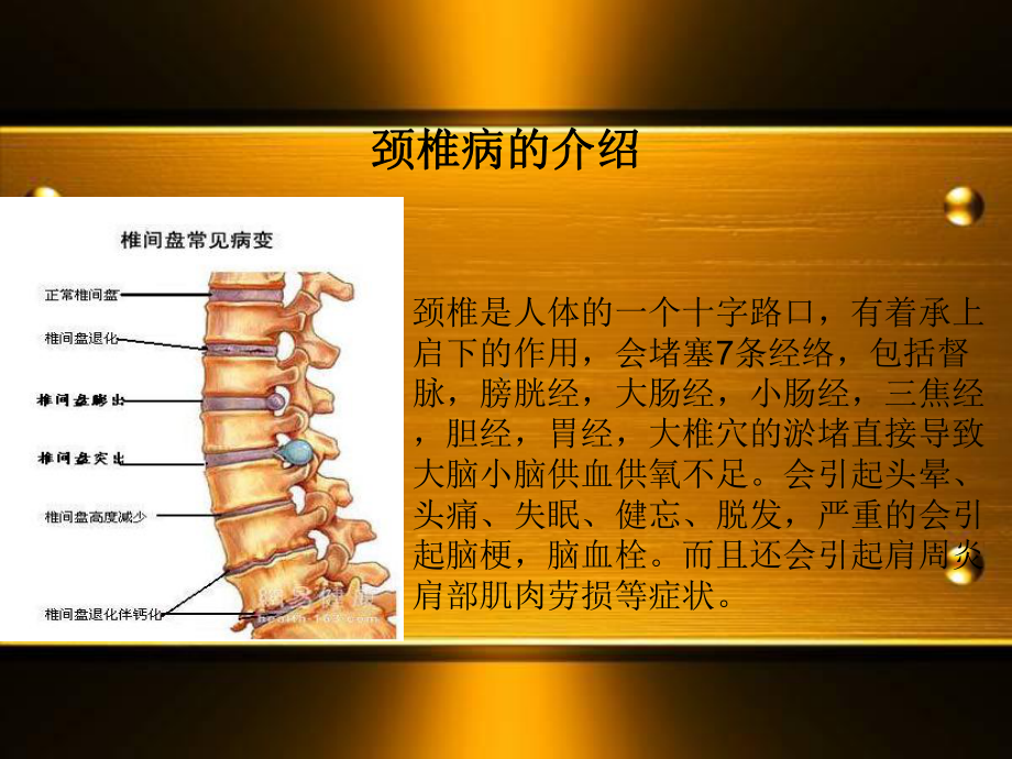 风湿骨病ppt演示课件.ppt_第2页