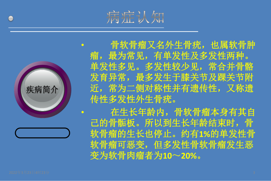 骨软骨瘤PPT课件.ppt_第3页