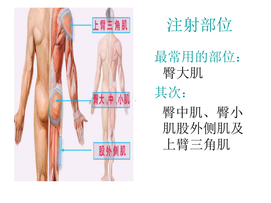 最新肌肉注射-PPT(精)课件.ppt_第3页