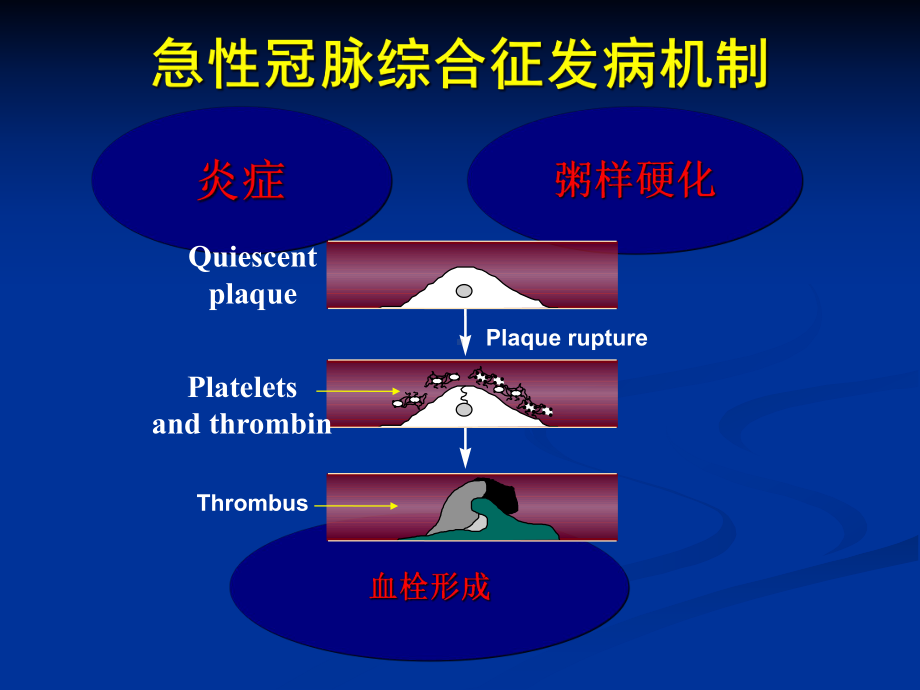 替罗非班专家版课件.ppt_第3页