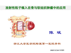 放射性粒子植入在骨与课件.ppt