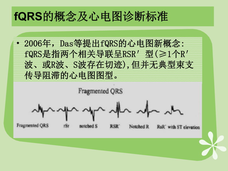 碎裂QRS波课件.ppt_第2页