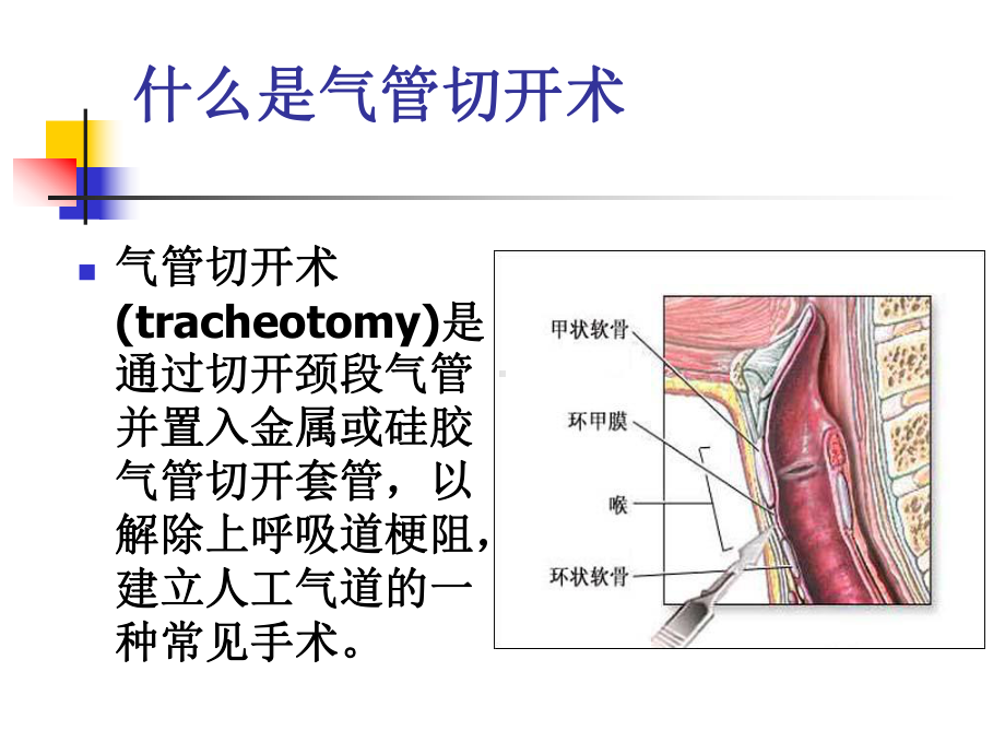 气管切开护理课件.ppt_第3页