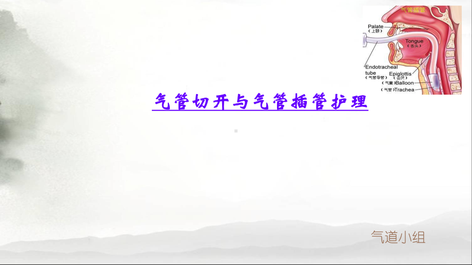 气管切开及气管插管护理课件.ppt_第1页