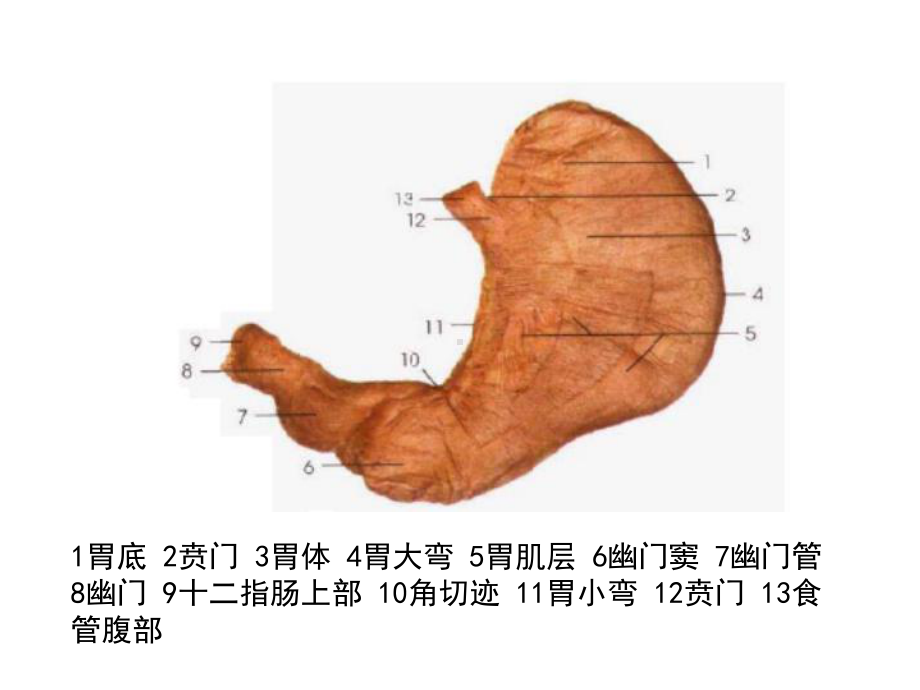 病理学胃炎胃溃疡课件.ppt_第3页