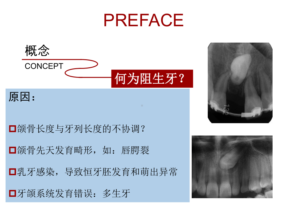 第4章牙及牙槽外科-课件.ppt_第2页