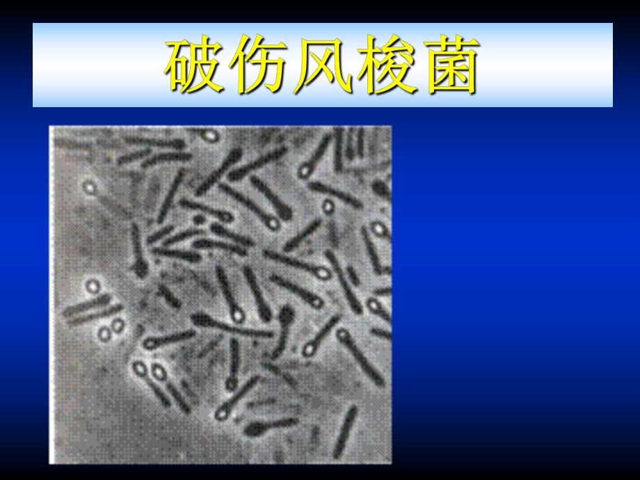 破伤风梭菌课件.ppt_第1页