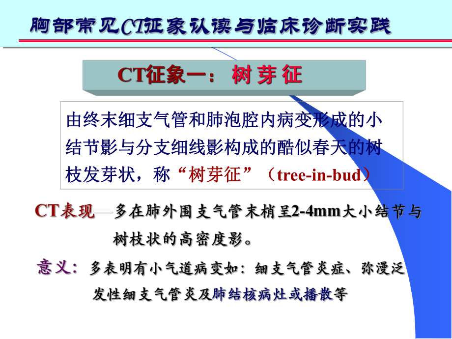 肺部CT十大征象课件.ppt_第3页