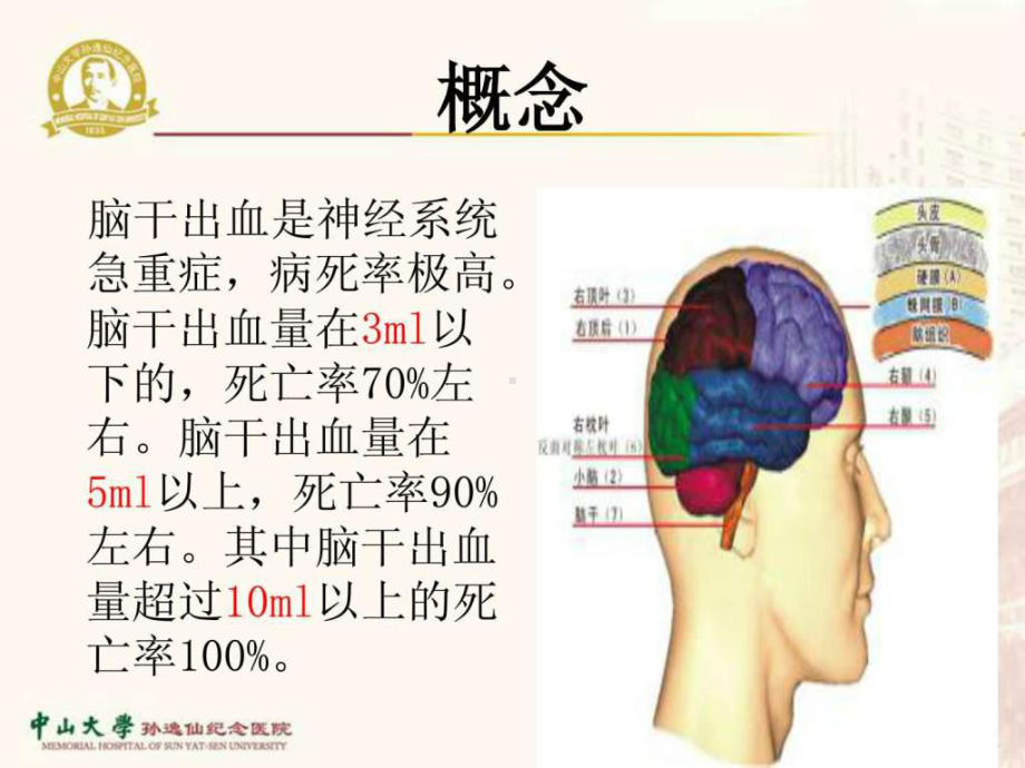 脑干出血的护理-课件.ppt_第3页