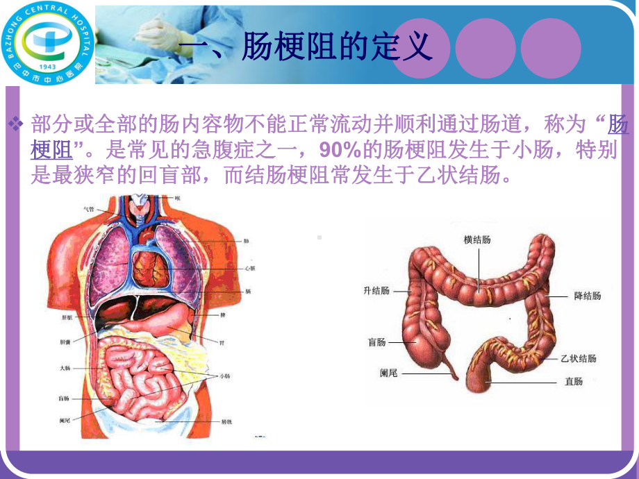 肠梗阻护理查房课件.ppt_第2页