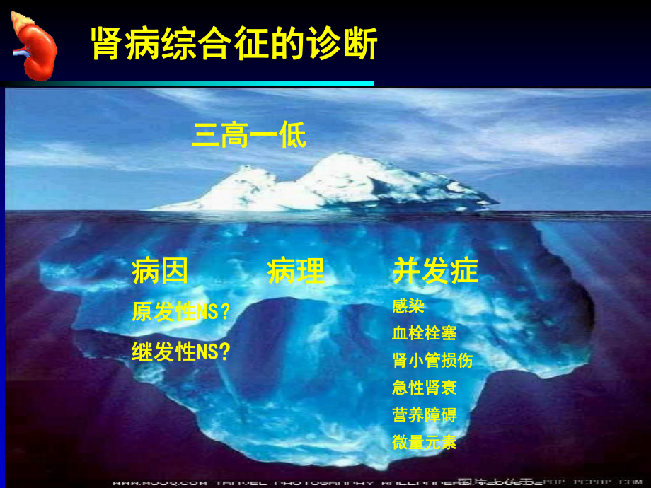 肾病综合征临床常见并发症课件.ppt_第2页