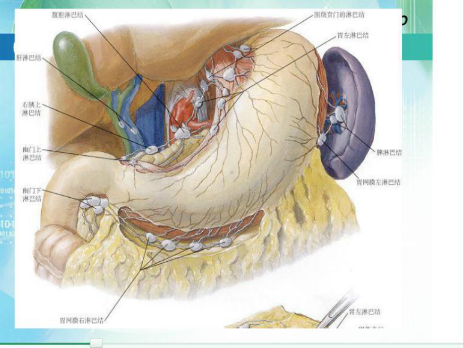 胃癌淋巴结及CT表现课件.ppt_第3页