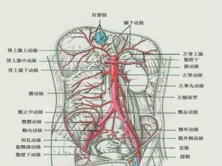 腹主动脉瘤的护理(讲课)课件.ppt_第3页