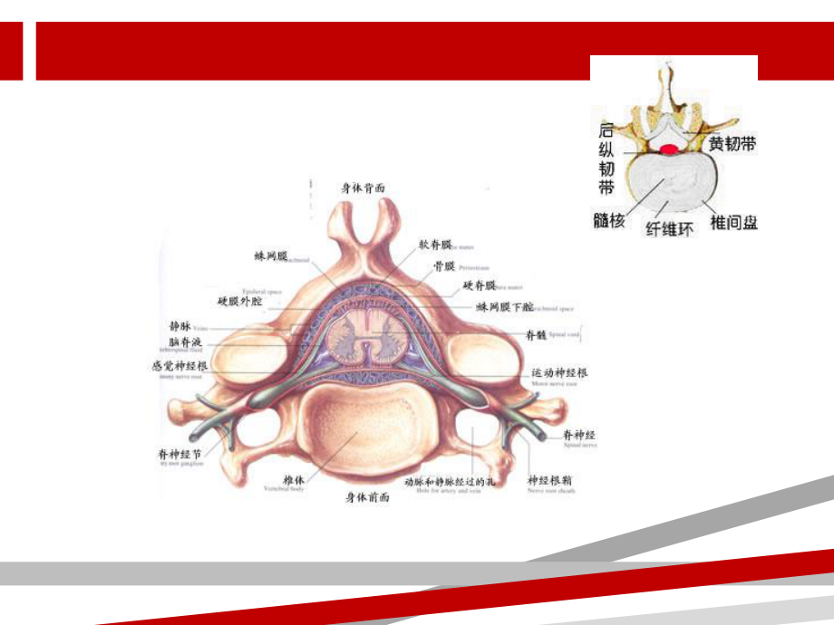 腰椎间盘突出症病人的护理.ppt课件.ppt_第2页