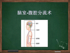 脑室腹腔分流术-PPT课件.ppt