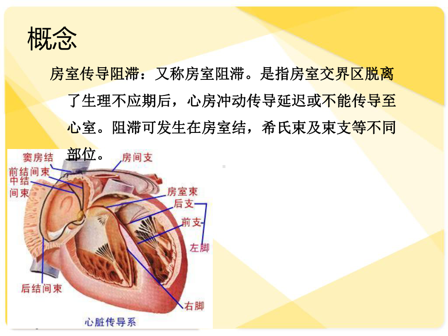 三度房室传导阻滞护理查房ppt演示课件.ppt_第3页