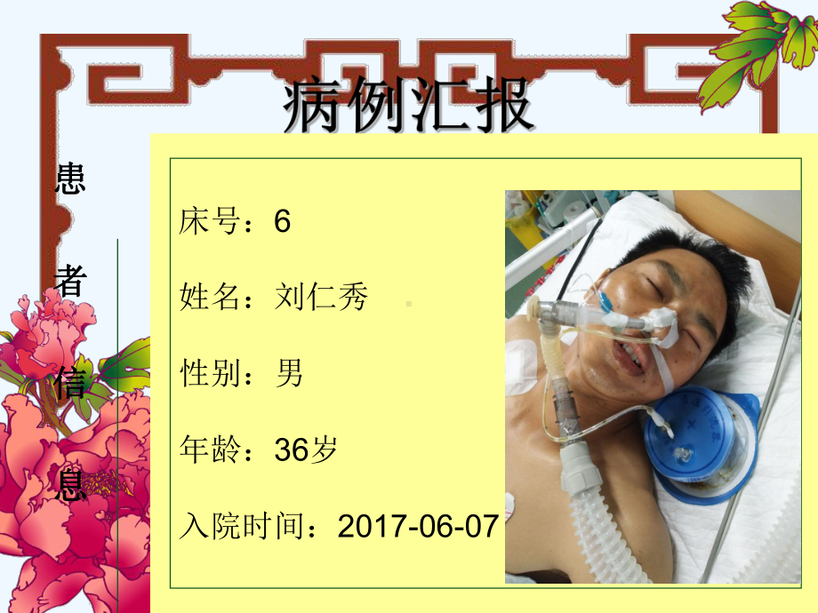 脂肪栓塞综合症预防及护理-课件.ppt_第2页