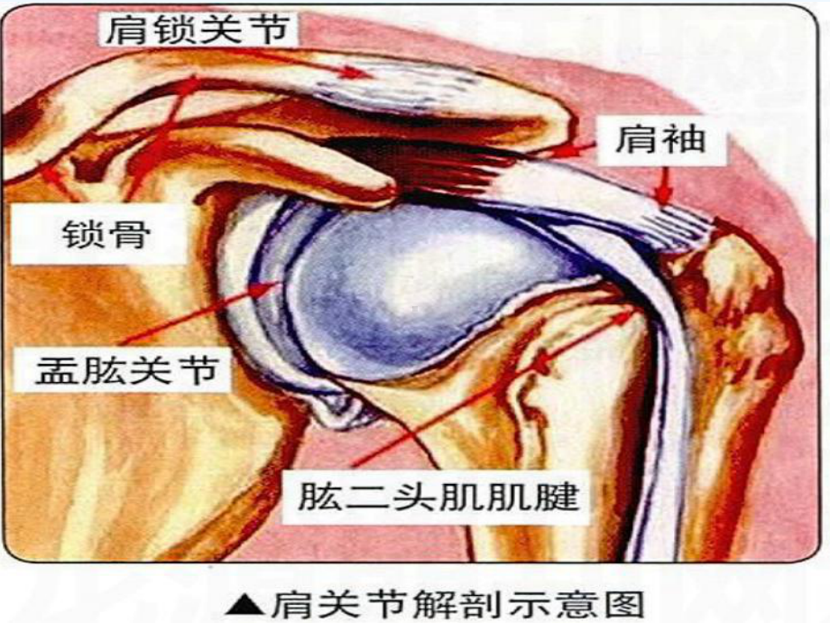 肩袖损伤患者护理查房课件.ppt_第3页