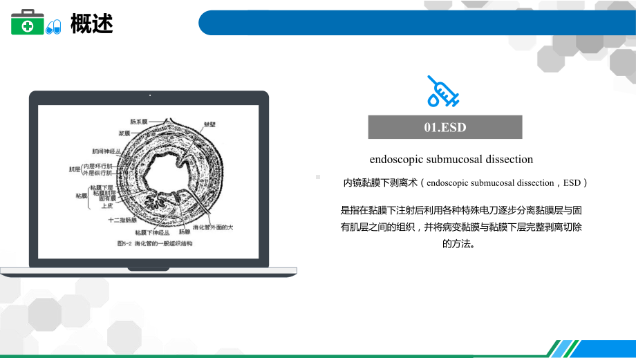 ESD患者护理要点及健康教育图文PPT教学课件.pptx_第3页