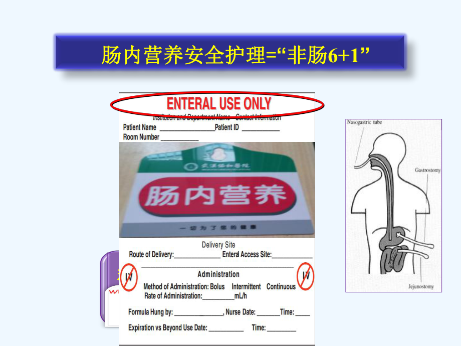 肠内营养返流误吸的预防与护理课件.ppt_第2页