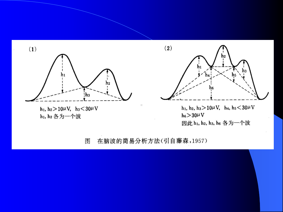 脑电图基本知识分析课件.ppt_第3页