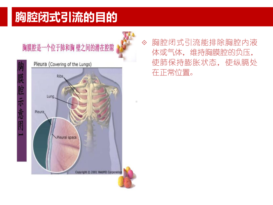 胸腔闭式引流的护理及注意事项.ppt课件.ppt_第3页