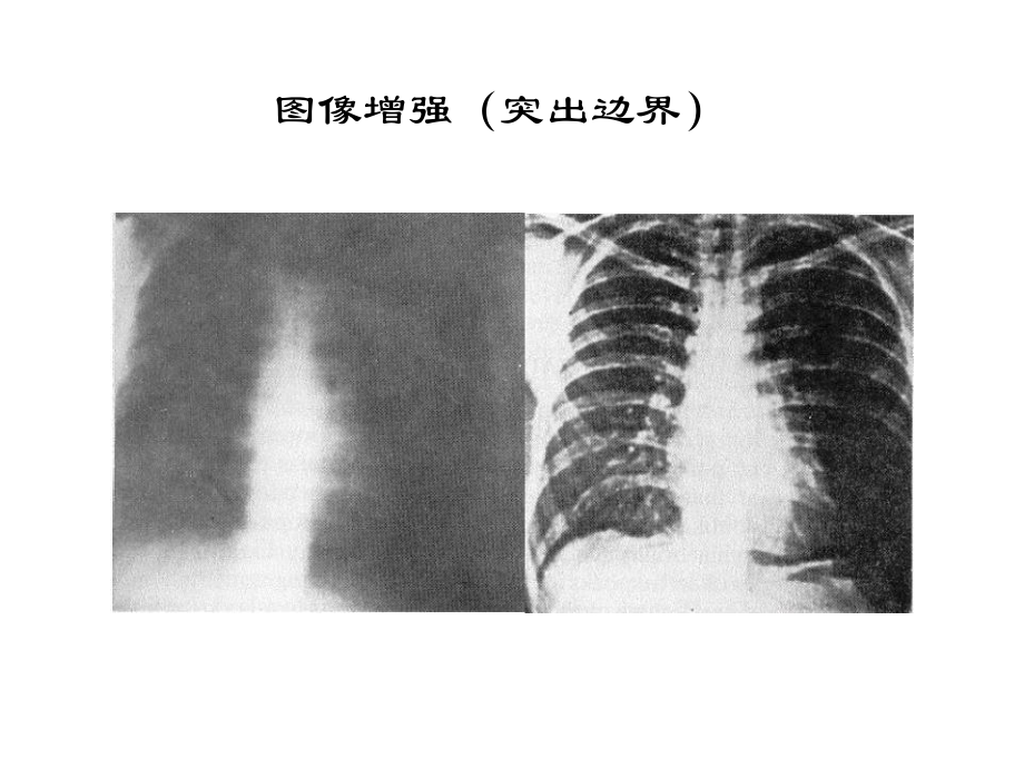 第八讲-图像增强课件.ppt_第3页