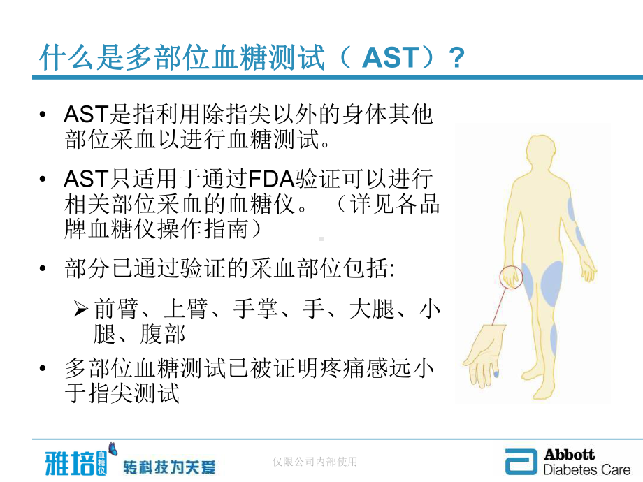 多部位血糖测试-AST课件.ppt_第2页