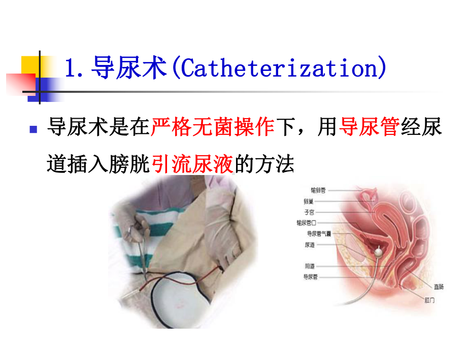 女病人导尿ppt课件.ppt_第3页