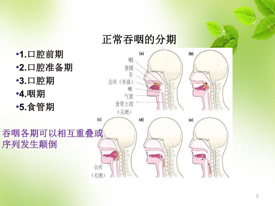 吞咽困难护理查房PPT演示课件.ppt_第3页