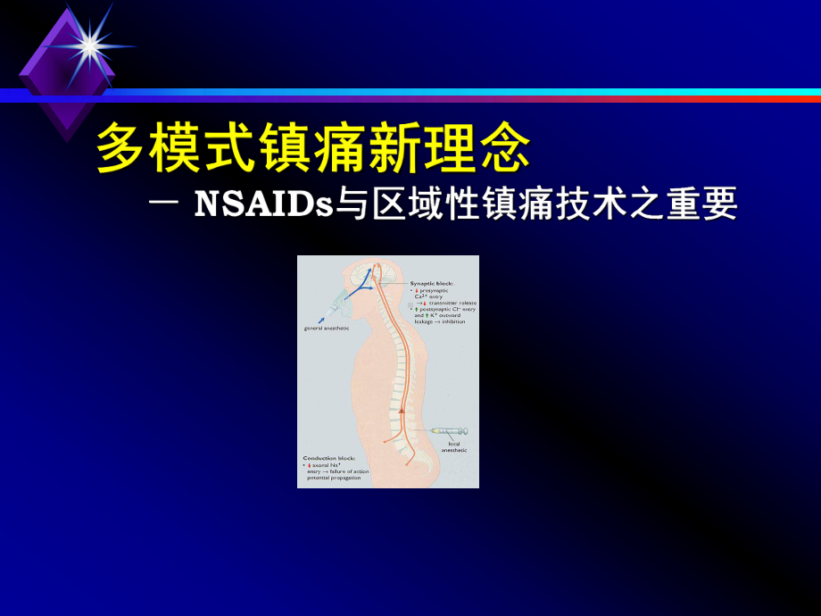 多模式镇痛新理念课件.ppt_第1页