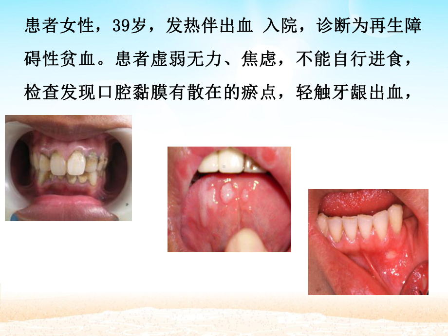 口腔护理及操作PPT课件.ppt_第2页