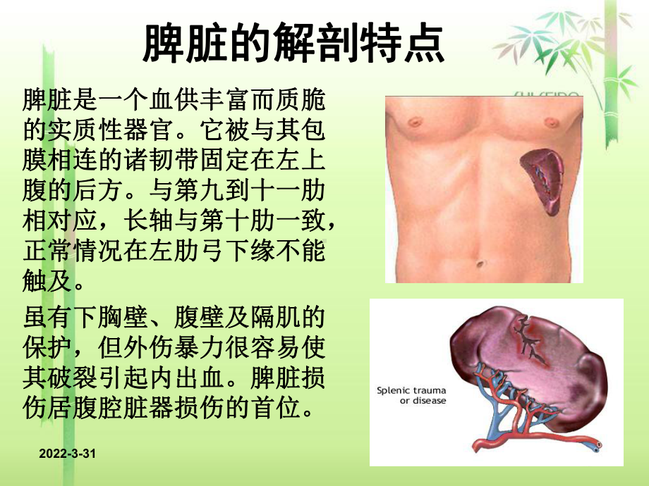 外伤性脾破裂的护理查房ppt课件.ppt_第2页