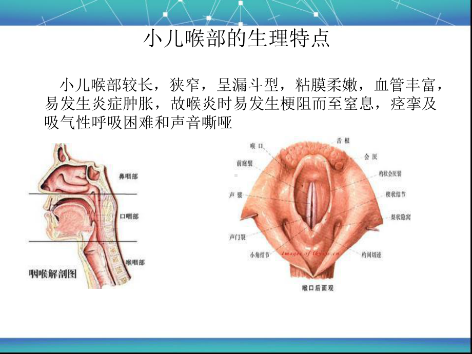 喉炎并喉梗阻护理查房课件.ppt_第2页