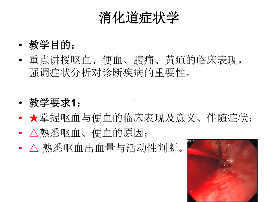 呕血便血腹痛黄疸精讲课件.ppt_第2页