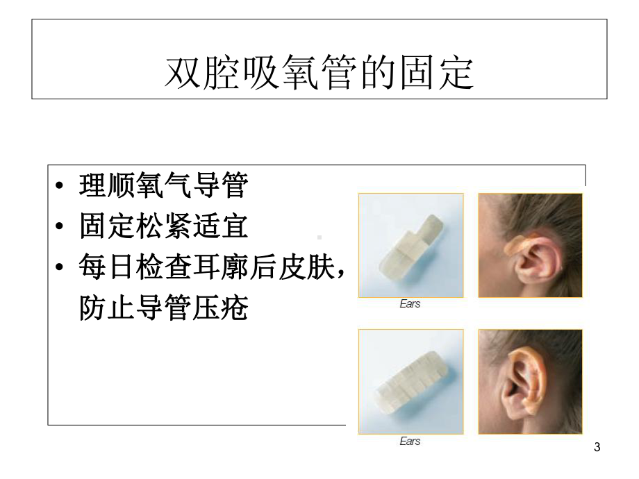 各种导管固定(课堂PPT)课件.ppt_第3页