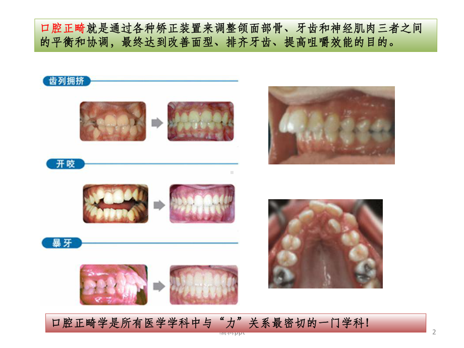 口腔正畸的力学课件.ppt_第2页