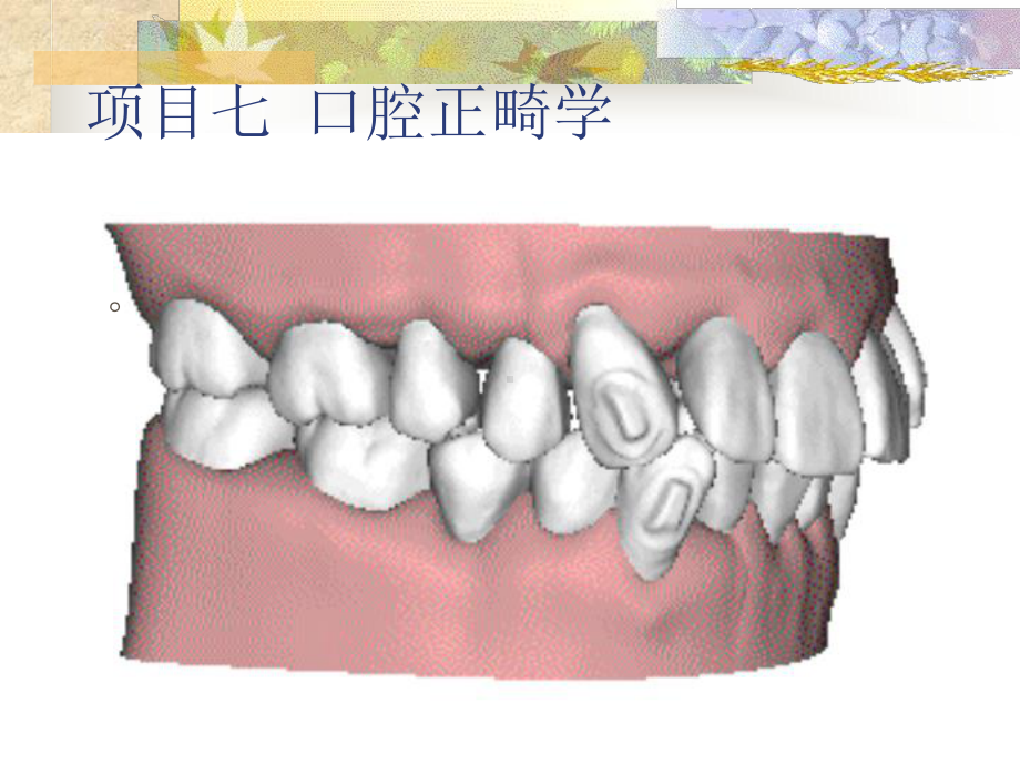 口腔正畸学概述汇总.课件.ppt_第2页