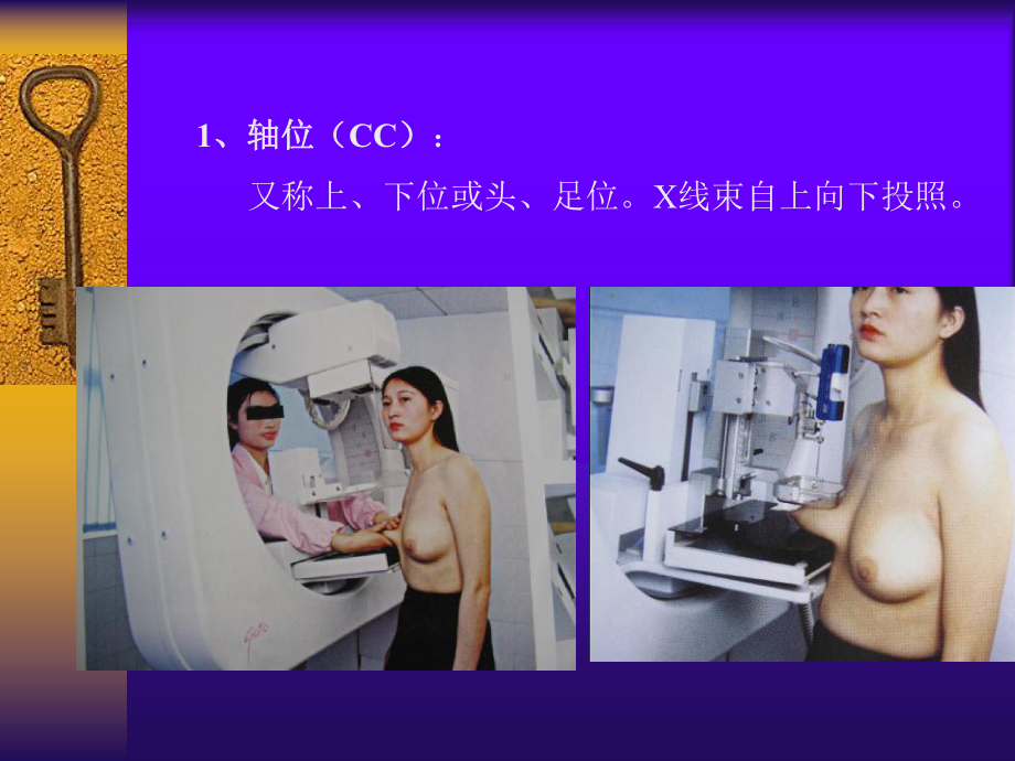 乳腺钼靶影像诊断学PPT课件.ppt_第2页