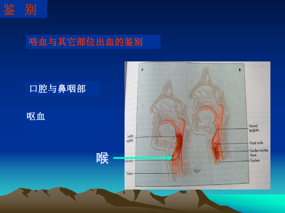 咯血课件.ppt_第3页