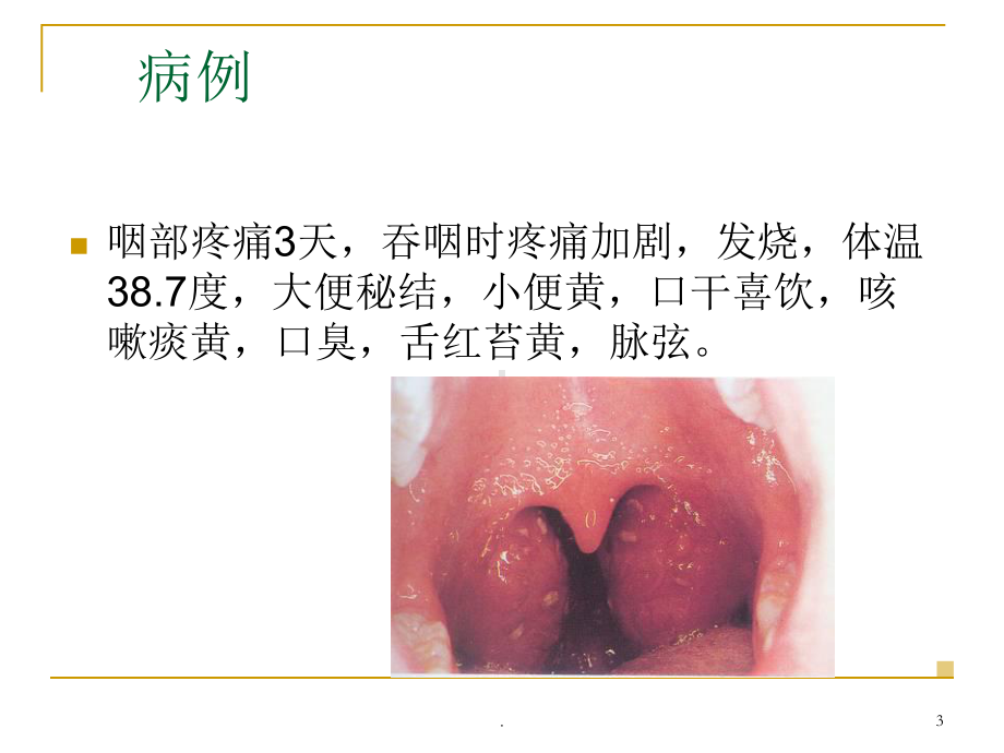 乳-蛾-PPT演示课件.ppt_第3页