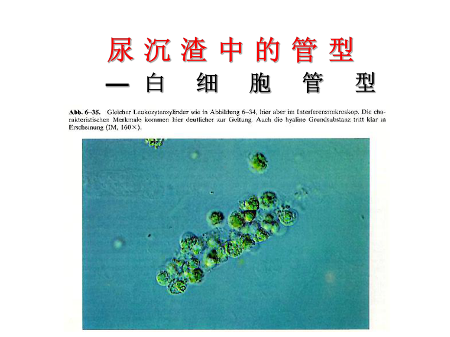 尿沉渣各种管型课件.ppt_第3页