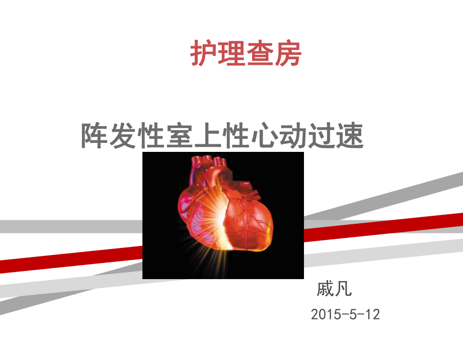 室性心动过速护理查房.ppt课件.ppt_第1页