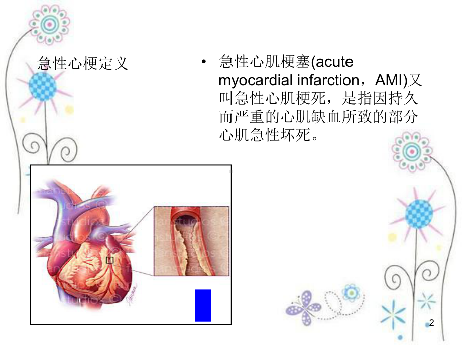 急性心梗急诊行PCI术中配合ppt课件.ppt_第2页