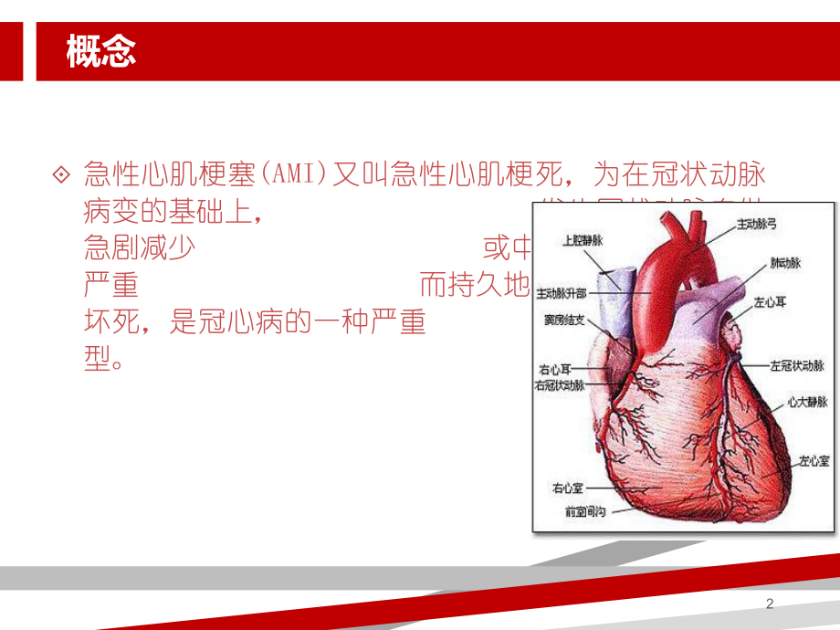 急性心肌梗死的护理措施78472.ppt课件.ppt_第2页