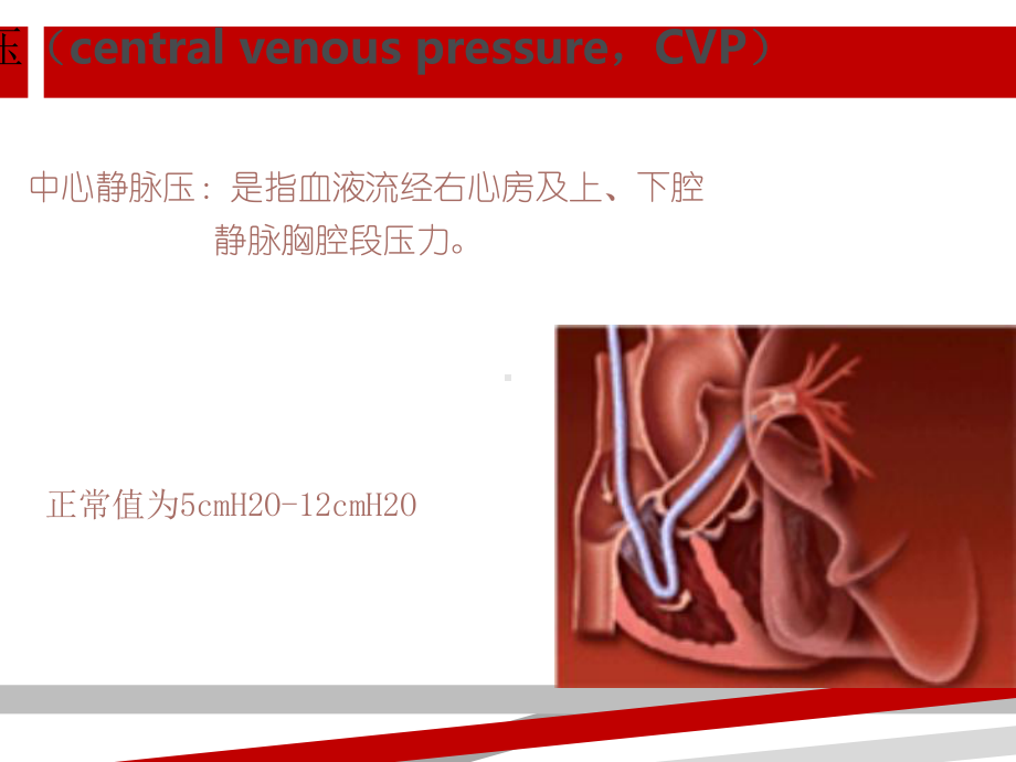 中心静脉压.ppt课件.ppt_第2页