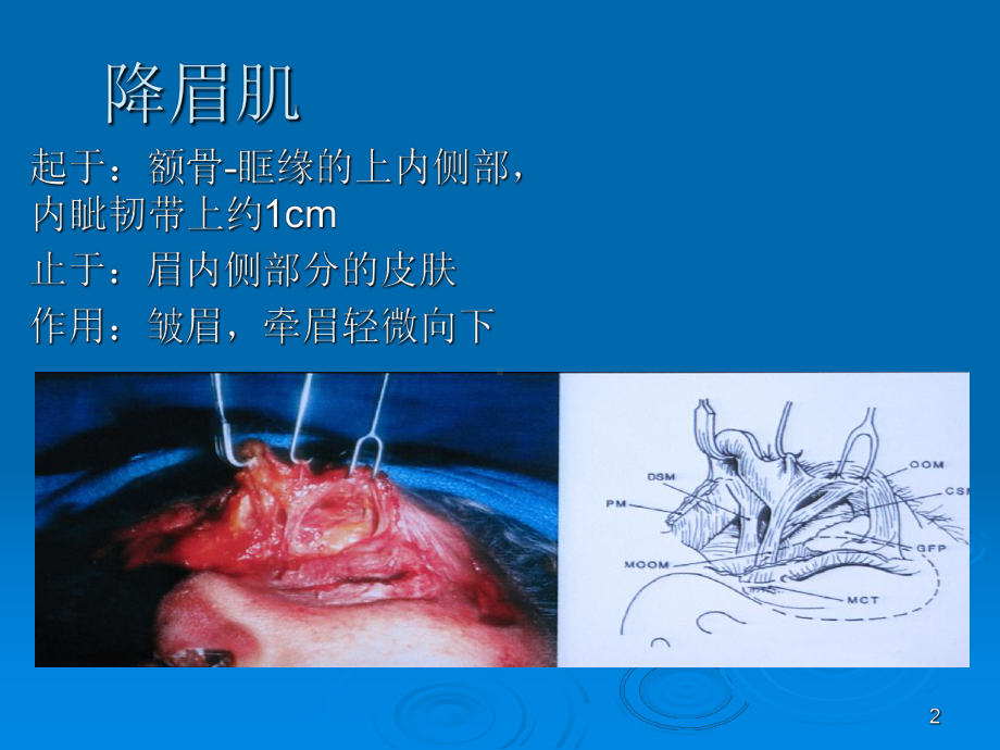 微整形PPT学习课件.ppt_第2页