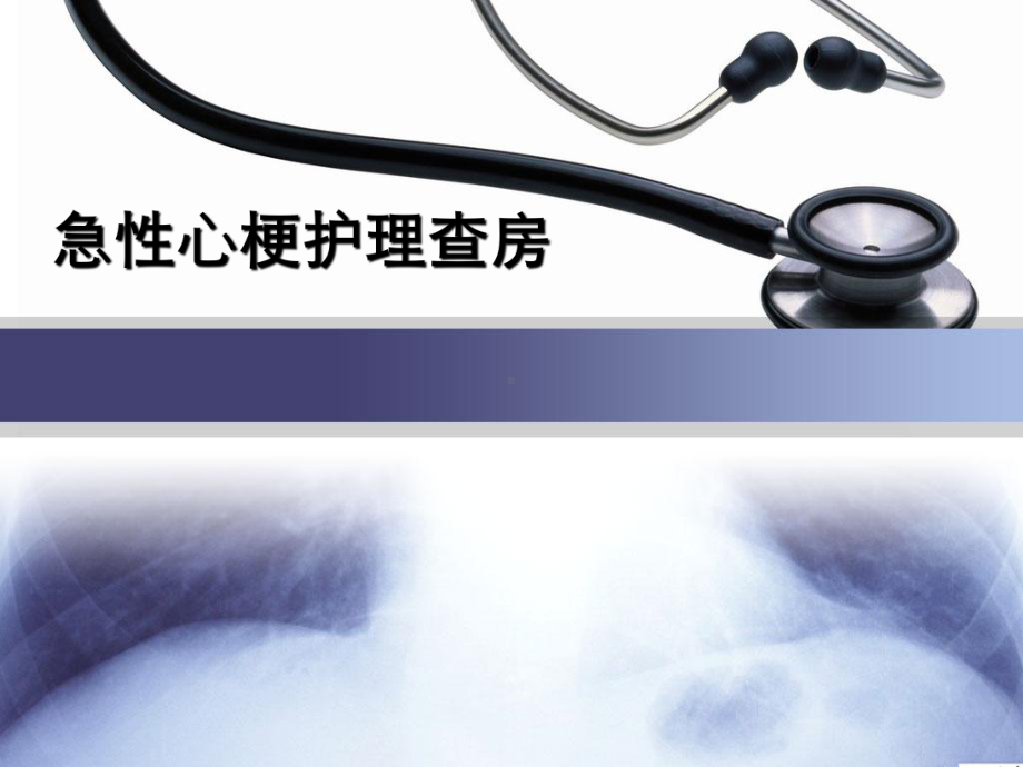 急性心肌梗死护理查房课件.ppt_第1页