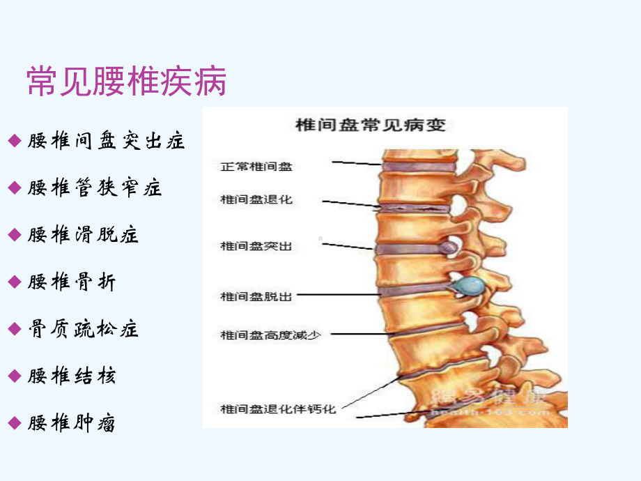 常见腰椎疾病诊断及治疗课件.ppt_第2页